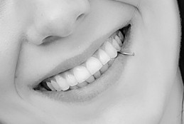 How to get naturally whiter teeth