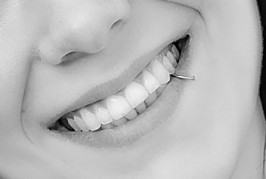 How to get naturally whiter teeth